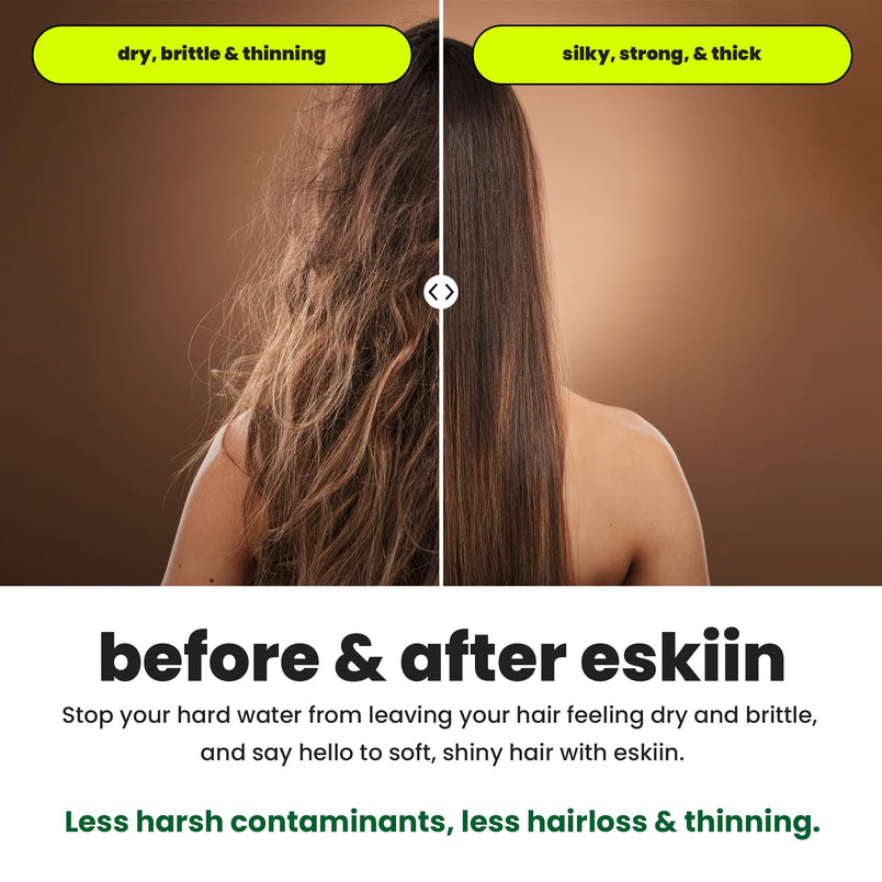 Eskiin Filtered Showerhead With Filters For Healthy Hair & Skin